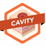 Cavity wound type