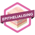 Epitheliasing wound type