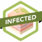 Infected wound type